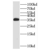 WB analysis of K-562 cells, using RCBTB1 antibody (1/200 dilution).