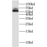 WB analysis of mouse thymus tissue, using RCBTB2 antibody (1/2000 dilution).