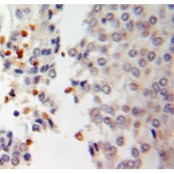 Regulator Of Chromosome Condensation (RCC1) Antibody