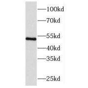 WB analysis of MCF7 cells, using SNHG3-RCC1 antibody (1/300 dilution).