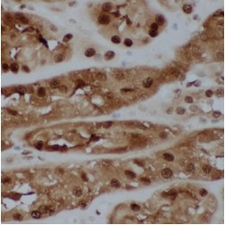 Regulator Of Chromosome Condensation (RCC1) Antibody