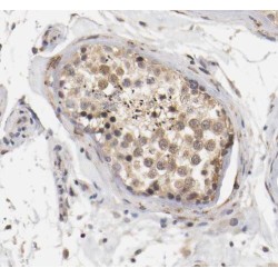 RAD52 Motif Containing 1 (RDM1) Antibody