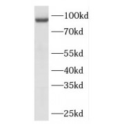 WB analysis of human testis tissue, using REC8 antibody (1/1000 dilution).
