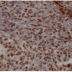 Recoverin (RCVRN) Antibody