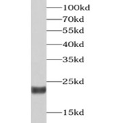 WB analysis of mouse eye tissue, using RCVRN antibody (1/1000 dilution).