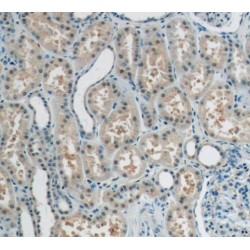 RecQ Like Helicase 4 (RECQL4) Antibody