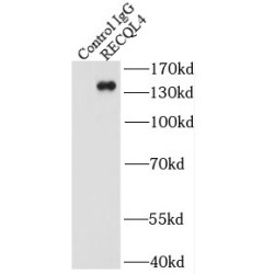 RecQ Like Helicase 4 (RECQL4) Antibody