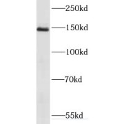 WB analysis of HeLa cells, using RECQL4 antibody (1/1000 dilution).