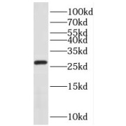 WB analysis of mouse brain tissue, using REEP2 antibody (1/1500 dilution).