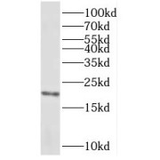 WB analysis of human liver tissue, using REEP5 antibody (1/500 dilution).