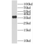 WB analysis of fetal human brain tissue, using REM2 antibody (1/1000 dilution).