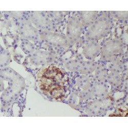 Renin (REN) Antibody