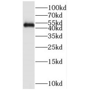 WB analysis of Jurkat cells, using REXO4,REX4 antibody (1/1000 dilution).