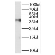 WB analysis of HeLa cells, using RFC2 antibody (1/600 dilution).