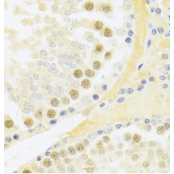 Replication Factor C Subunit 4 (RFC4) Antibody