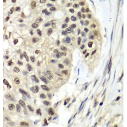 Replication Factor C Subunit 5 (RFC5) Antibody