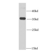 WB analysis of HeLa cells, using RFC5 antibody (1/1000 dilution).