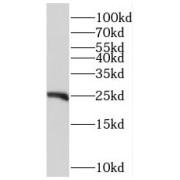 WB analysis of HeLa cells, using RFXAP antibody (1/1000 dilution).