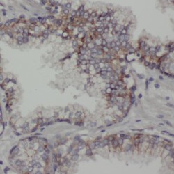 RPE-Retinal G Protein-Coupled Receptor (RGR) Antibody