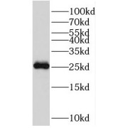 WB analysis of human heart tissue, using RGR antibody (1/500 dilution).