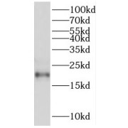 WB analysis of mouse thymus tissue, using RGS10 antibody (1/600 dilution).