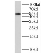 WB analysis of HL-60 cells, using RGS11 antibody (1/1000 dilution).