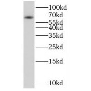 WB analysis of mouse brain tissue, using RGS14 antibody (1/1500 dilution).