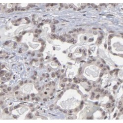 Regulator of G Protein Signaling 2 (RGS2) Antibody