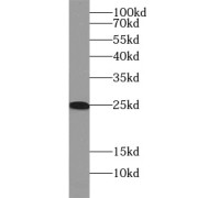 WB analysis of fetal human brain tissue, using RGS2 antibody (1/500 dilution).