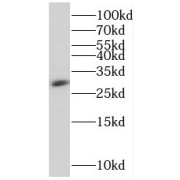 WB analysis of mouse cerebellum tissue, using RGS4 antibody (1/600 dilution).