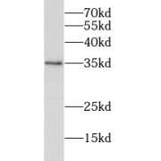 WB analysis of HeLa cells, using RHBDL2 antibody (1/500 dilution).