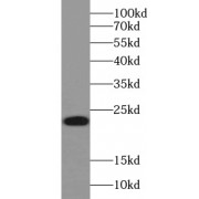 WB analysis of HeLa cells, using RHOA antibody (1/1000 dilution).