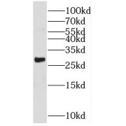 WB analysis of human testis tissue, using RHOT2 antibody (1/1000 dilution).