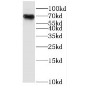 WB analysis of human brain tissue, using RHPN1 antibody (1/400 dilution).