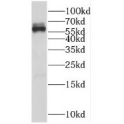 WB analysis of human brain tissue, using RIC8A antibody (1/200 dilution).