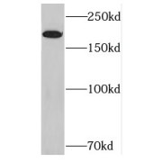 WB analysis of HEK-293 cells, using RICTOR antibody (1/4000 dilution).