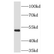 WB analysis of mouse skeletal muscle tissue, using RING1 antibody (1/500 dilution).