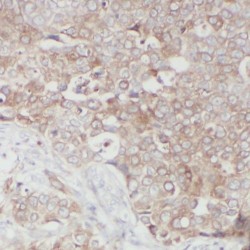 RAD50 Interactor 1 (RINT1) Antibody