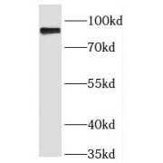 WB analysis of HepG2 cells, using RINT1 antibody (1/500 dilution).