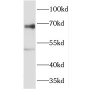 WB analysis of HEK-293T cells, using RIPK2 antibody (1/1000 dilution).