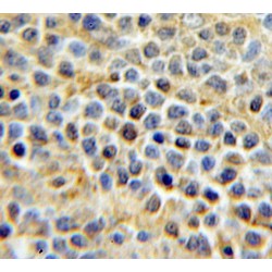 Unconventional Prefoldin RPB5 Interactor 1 (URI1) Antibody