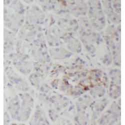 RNase T2 Antibody