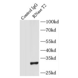 RNase T2 Antibody