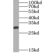 WB analysis of HEK-293 cells, using RNASET2 antibody (1/500 dilution).