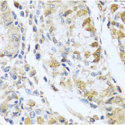 Ribonuclease 13 (RNASE13) Antibody