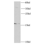 WB analysis of A431 cells, using RNASE13 antibody (1/1000 dilution).