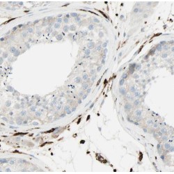 Ribonuclease H2 Subunit A (RNASEH2A) Antibody