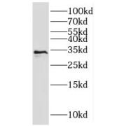 WB analysis of human liver tissue, using RNASEH2A antibody (1/500 dilution).