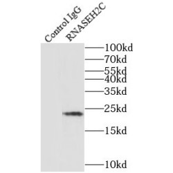 Ribonuclease H2 Subunit C (RNASEH2C) Antibody