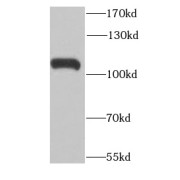 WB analysis of RAW 264.7 cells, using RNASEL antibody (1/1000 dilution).